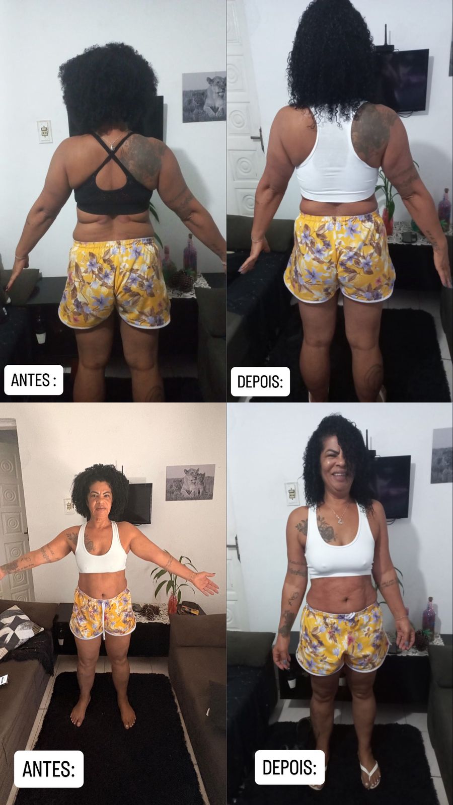 Antes e depois de paciente